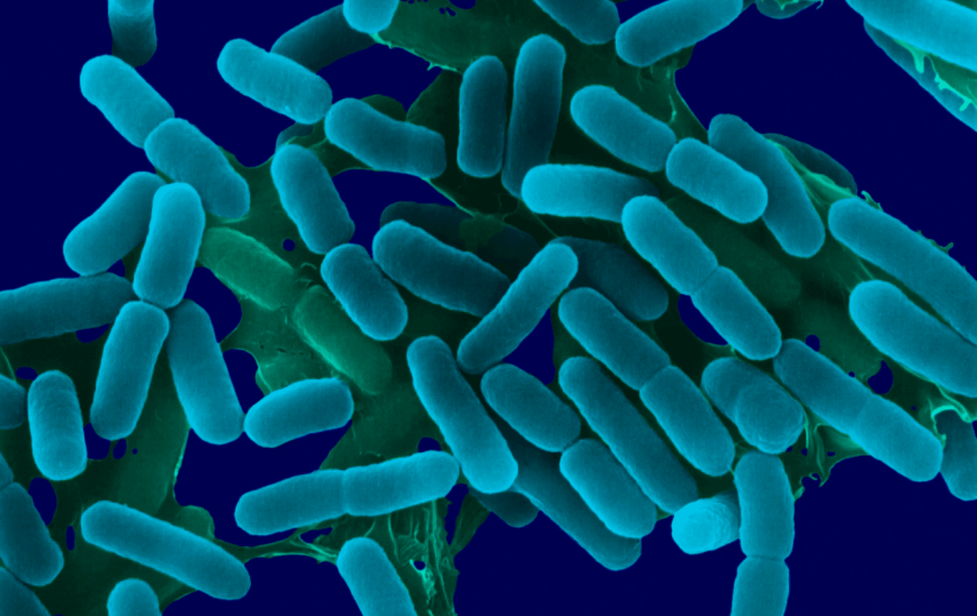Zwalczanie bakterii Legionella w wodzie.