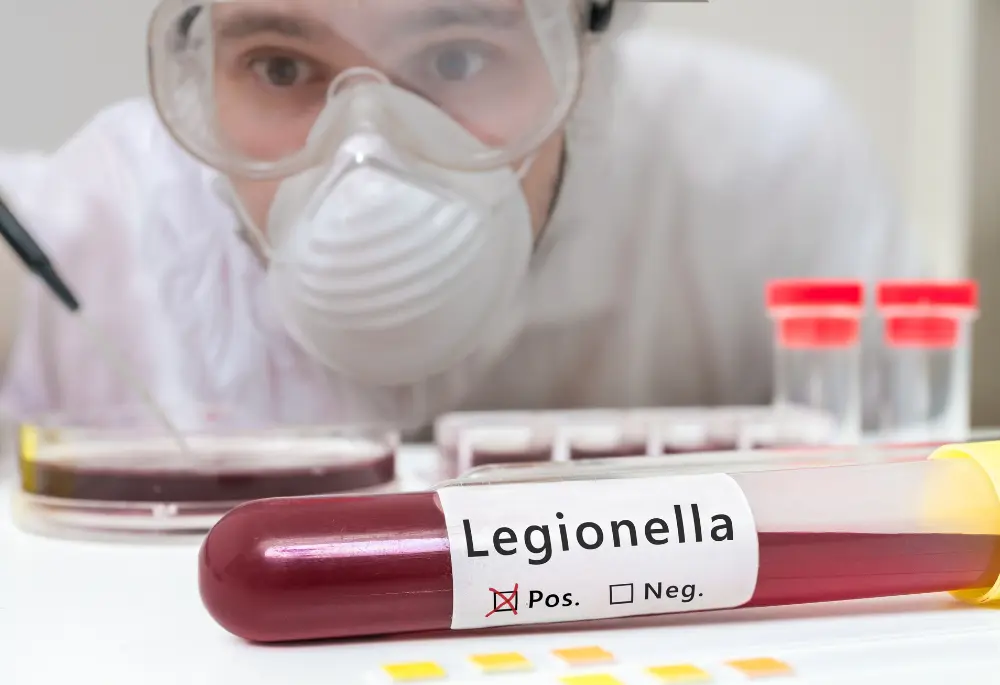 Laborant przyglądający się pozytywnej próbce krwi badanej na Legionellę.