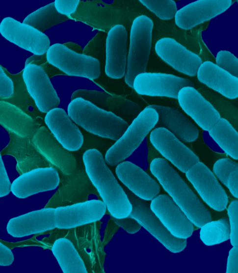 Zwalczanie bakterii Legionella w wodzie.